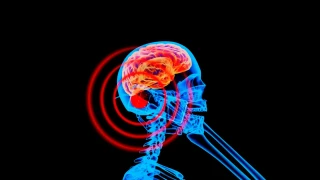 O uso intensivo de celulares pode aumentar o risco de câncer cerebral, sugere um novo estudo